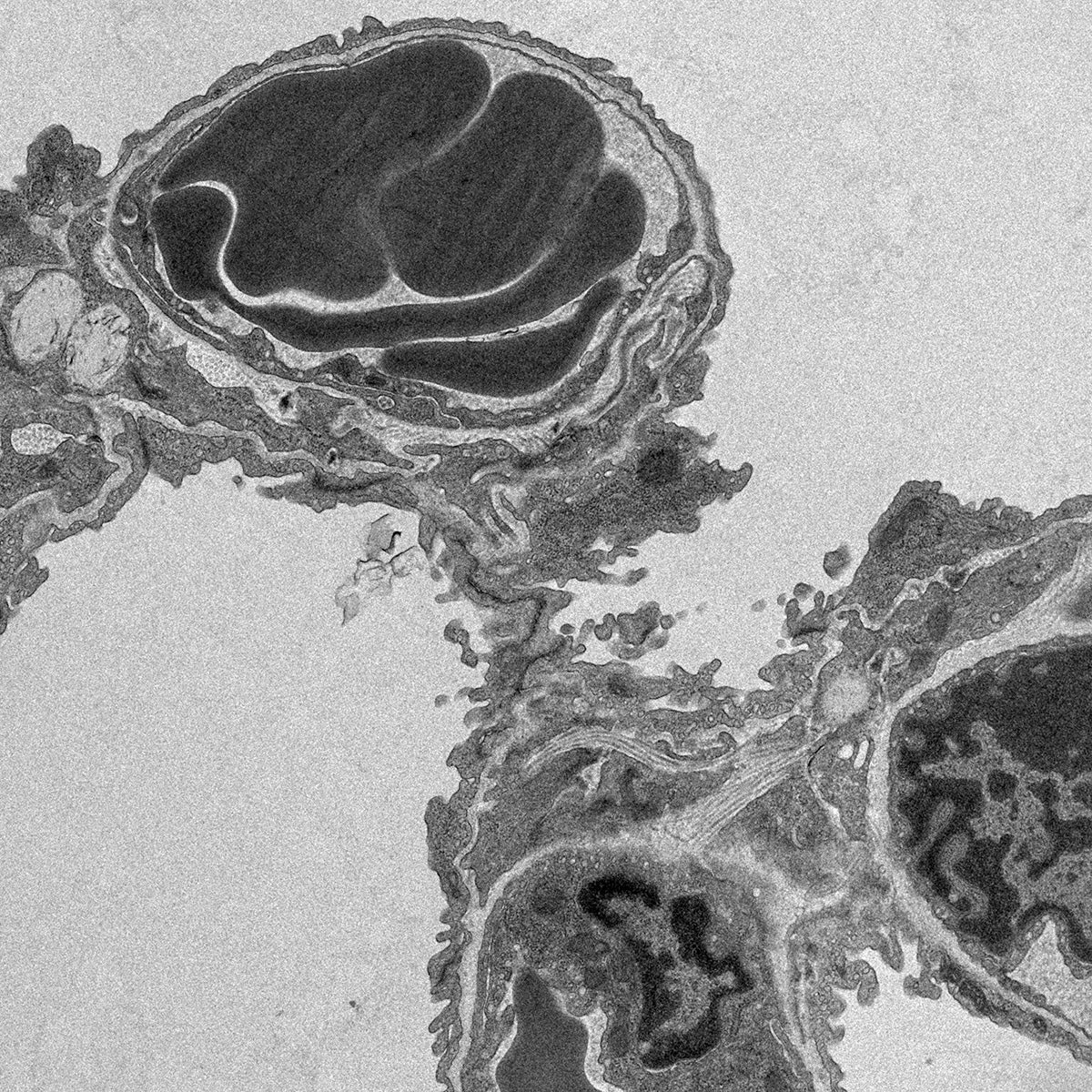 black and white scan from the ECES