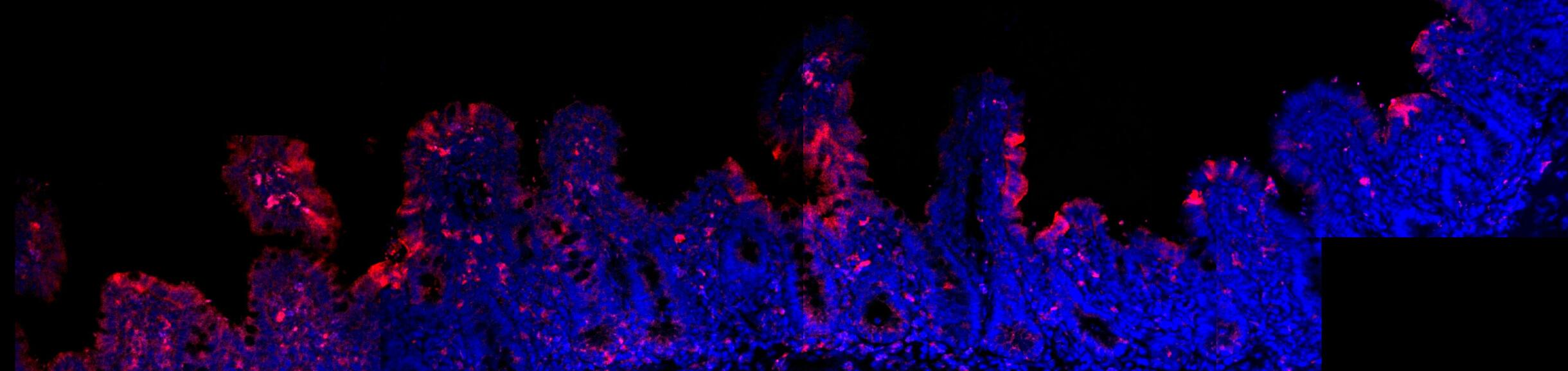 purple, blue and red scans on a microscope