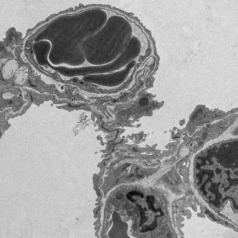 black and white scan from the ECES