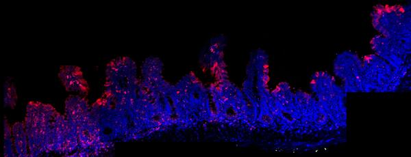 purple, blue and red scans on a microscope
